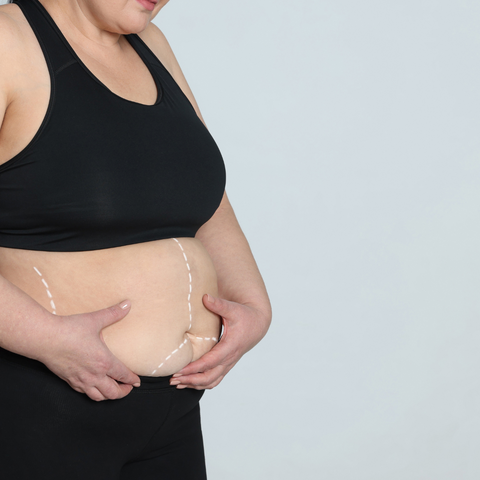 A bigger waistline could be a sign of metabolic syndrome – Nutri Intact